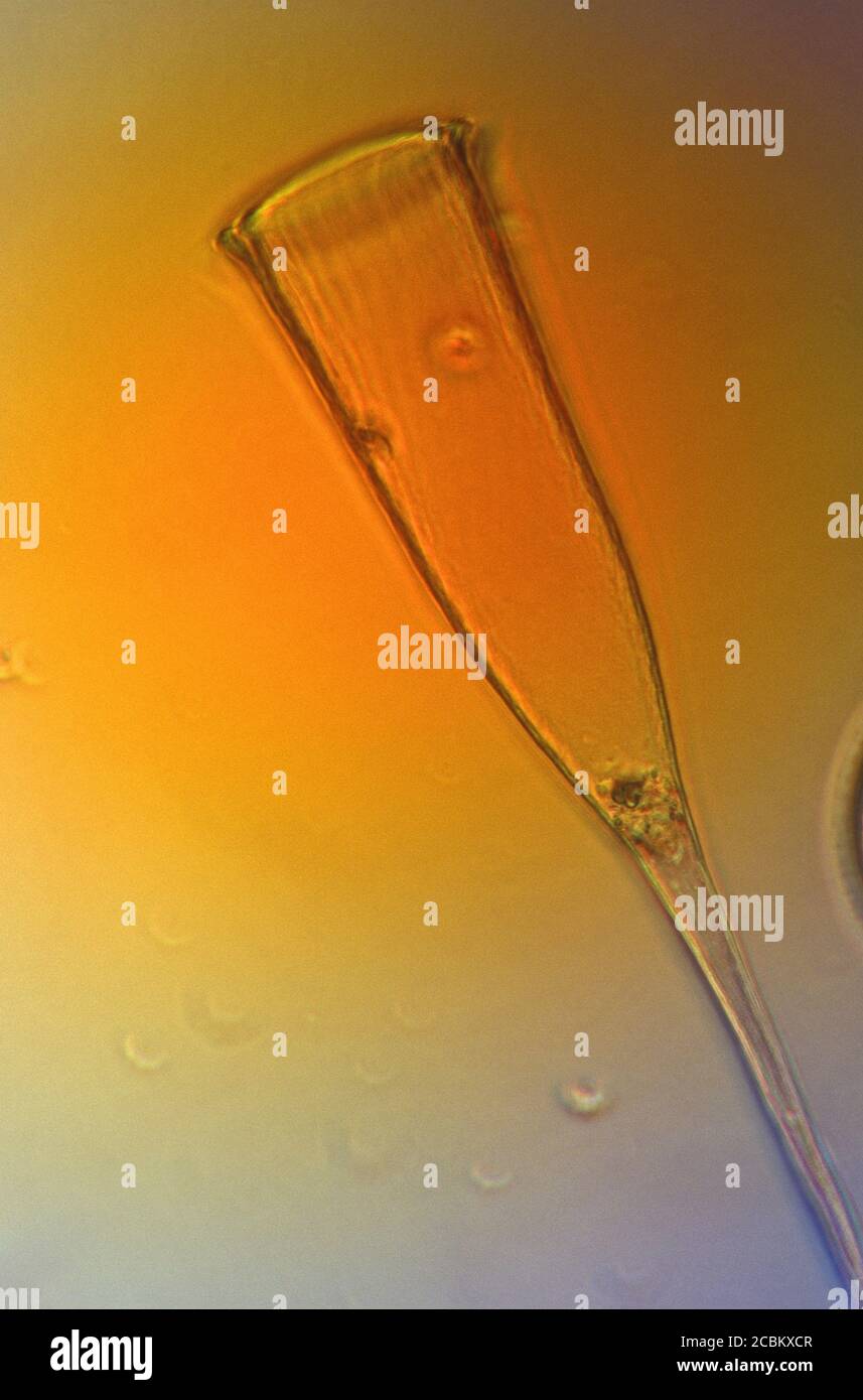 Microscopic view of tintinnid Stock Photo - Alamy Microscopic view of tintinnid Stock Photo - Alamy
