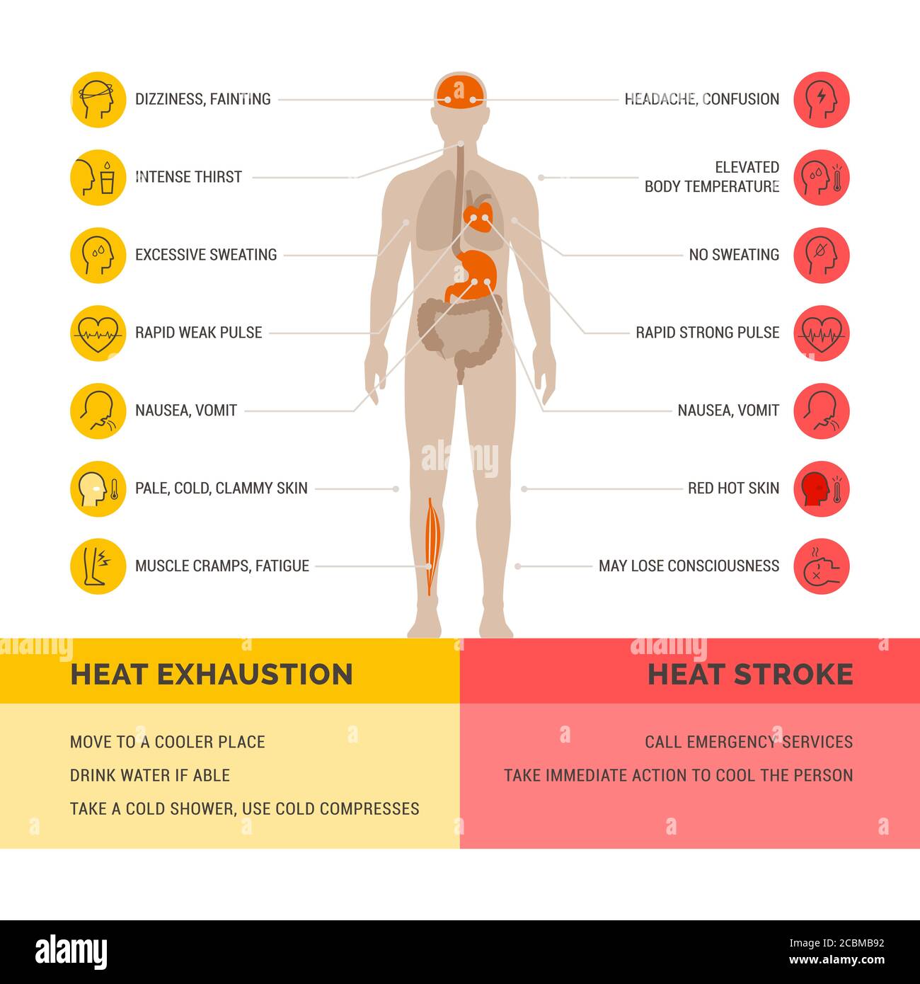 Heat exhaustion and heat stroke healthcare infographic: symptoms and first aid Stock Vector