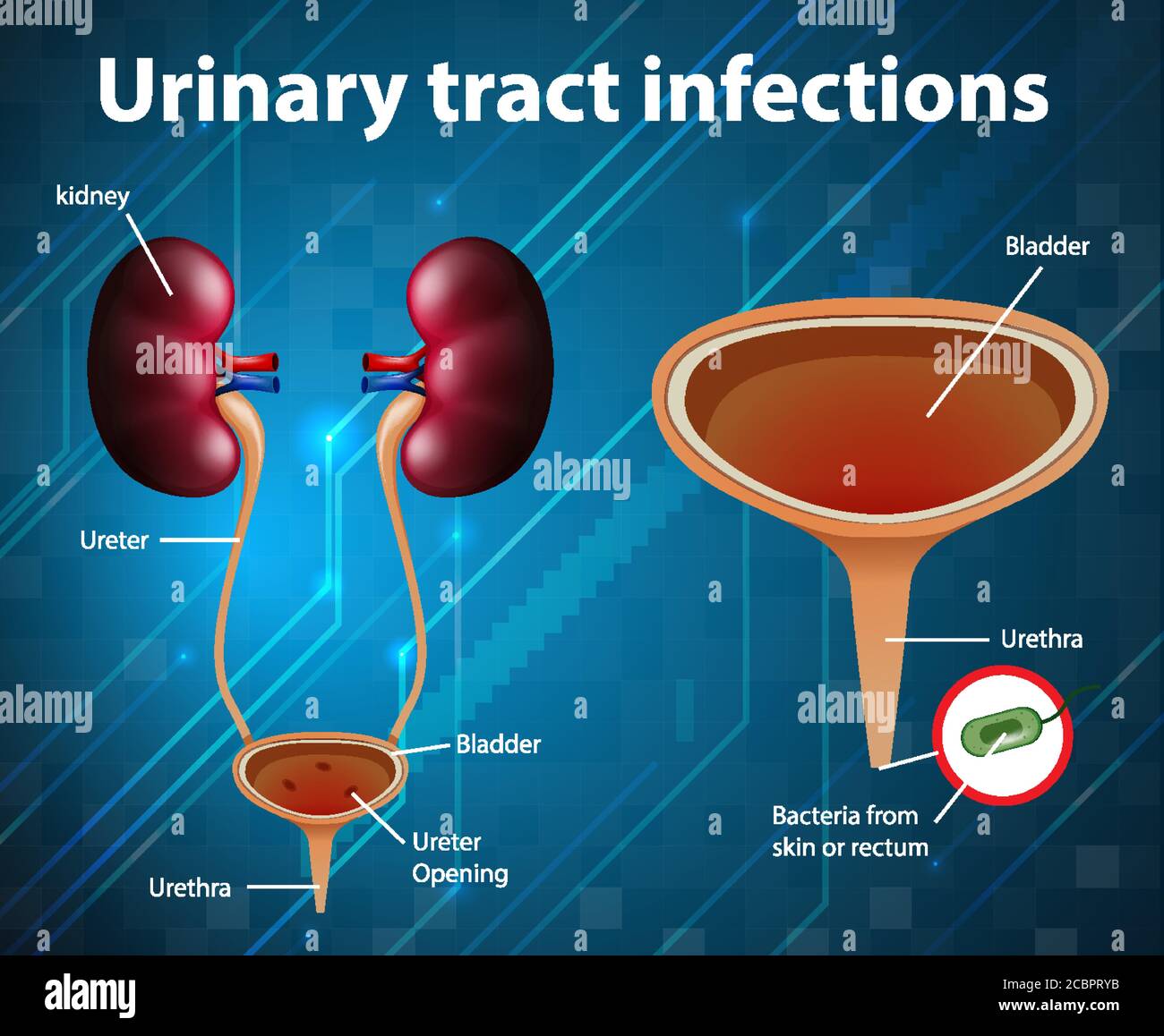 Urinary tract hi-res stock photography and images - Alamy