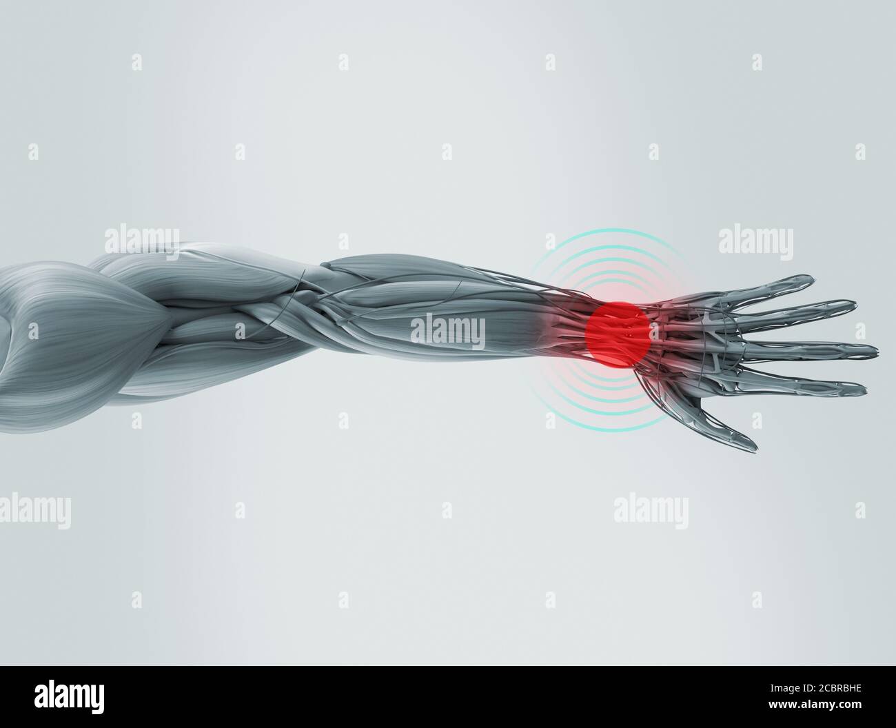 Human Arm Xray High Resolution Stock Photography and Images Alamy