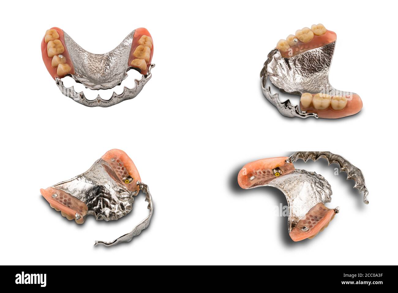 Upper partial denture Cut Out Stock Images & Pictures Alamy