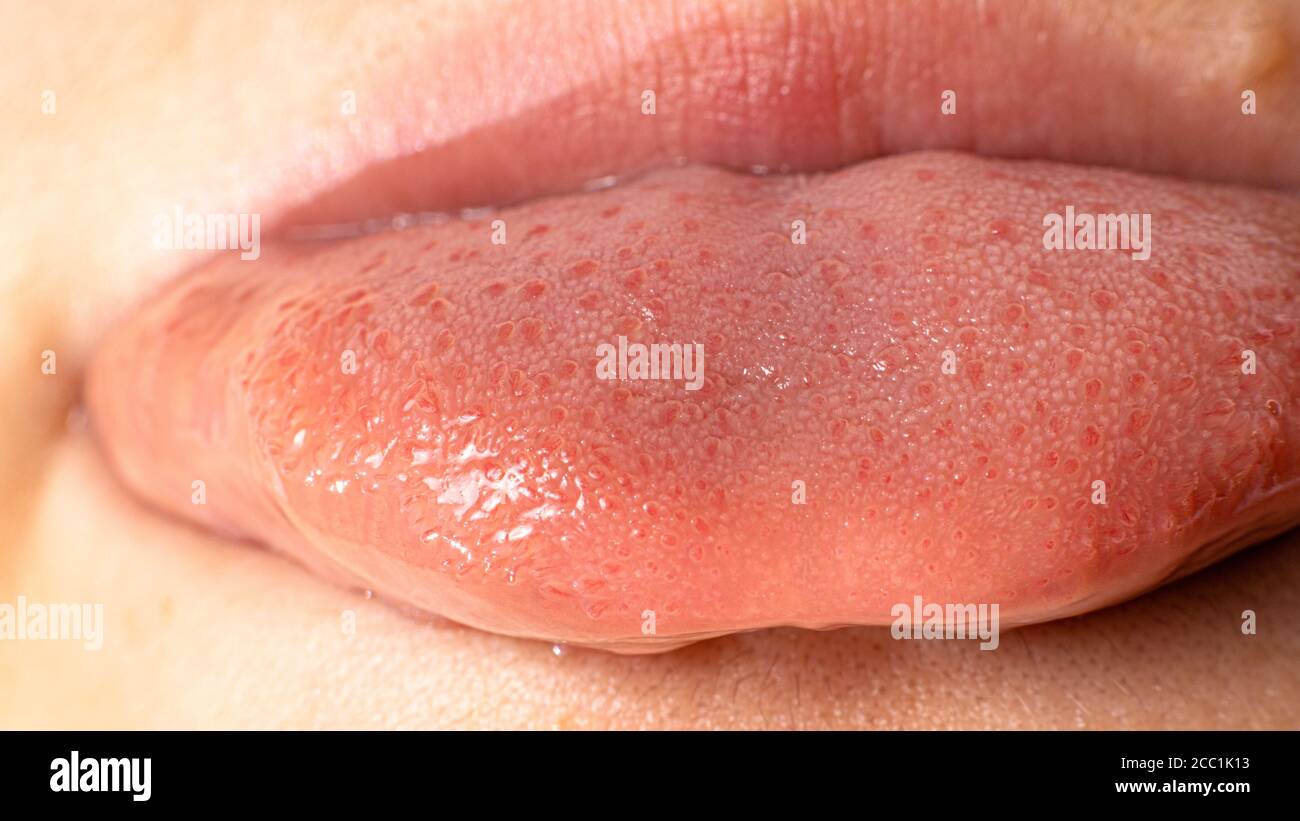 Tongue papillae taste buds and taste. Close up. Stock Photo
