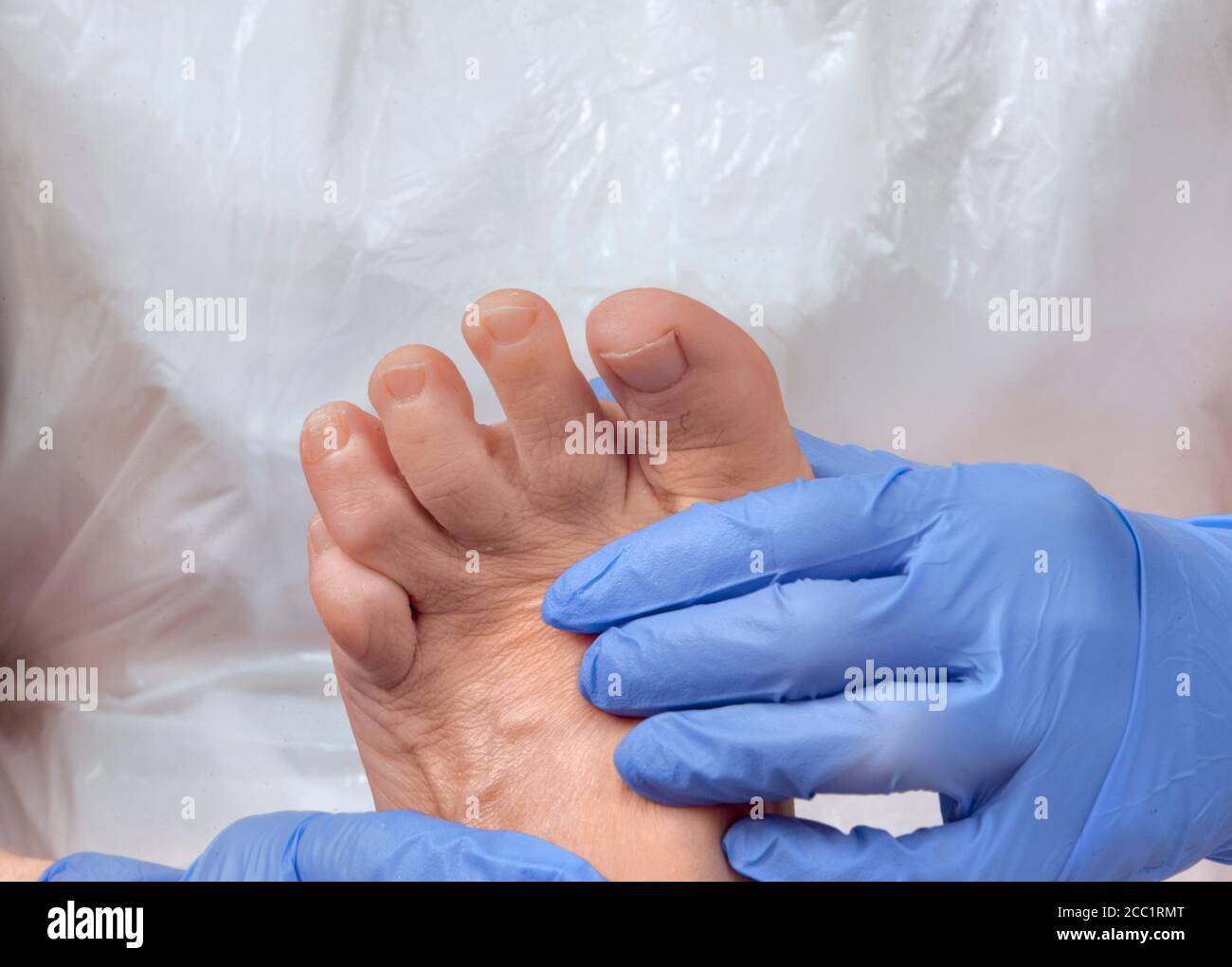 Chiropodist/podiatrist examines a woman's foot Stock Photo