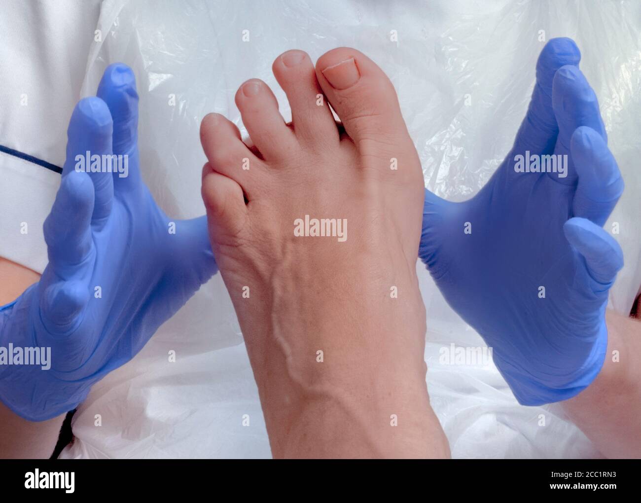 Chiropodist/podiatrist examines a woman's foot Stock Photo