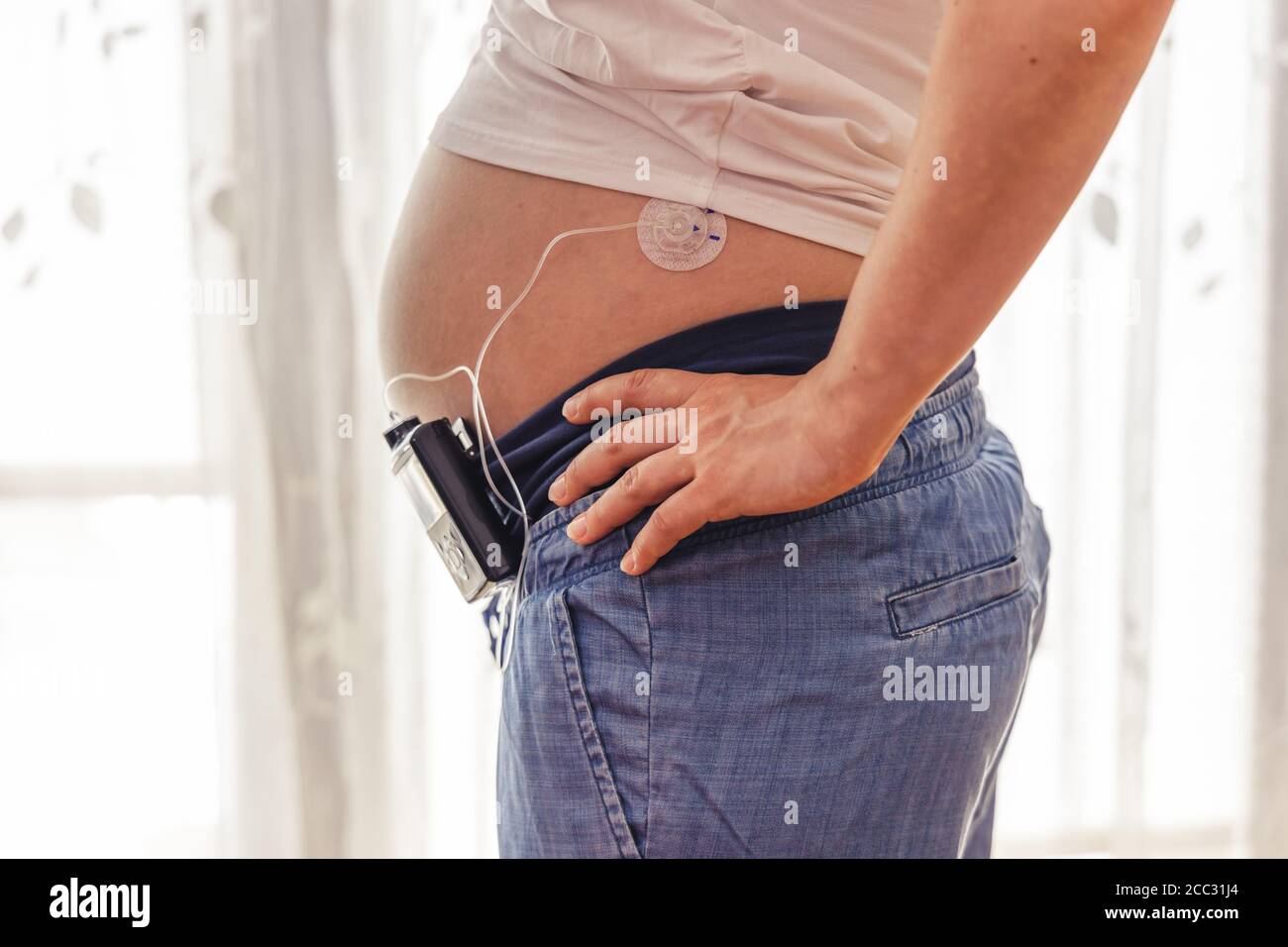 Pregnant woman with insuline pump on her pants and drainage mounted on her belly. Modern