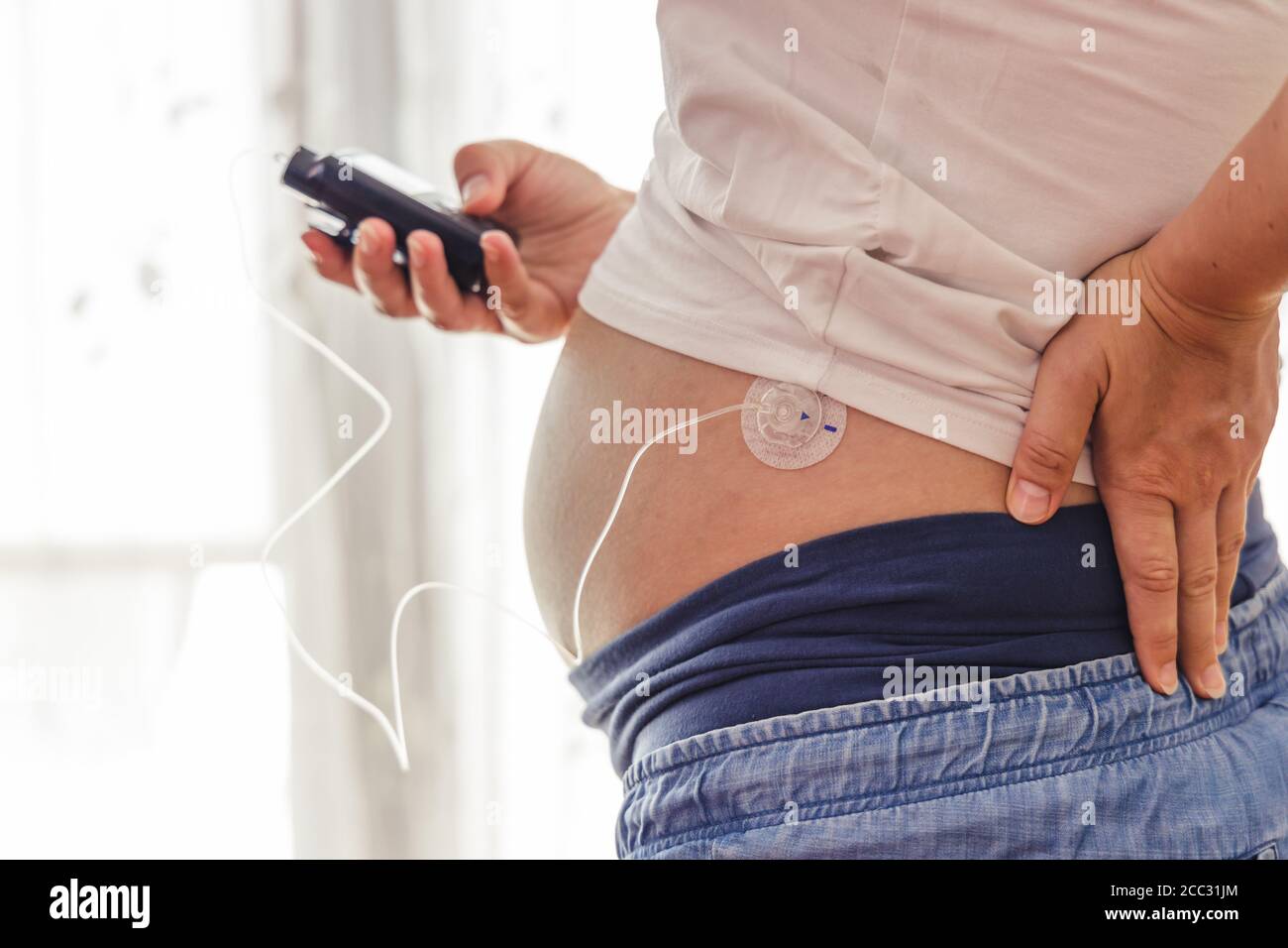 Pregnant woman operates insuline pump. Modern diabetes treatment through insulin given by a