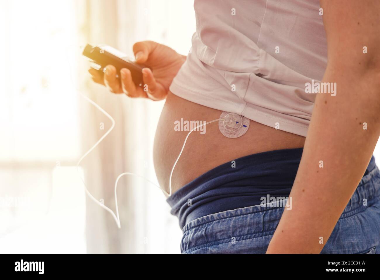 Pregnant woman operates insuline pump. Modern diabetes treatment