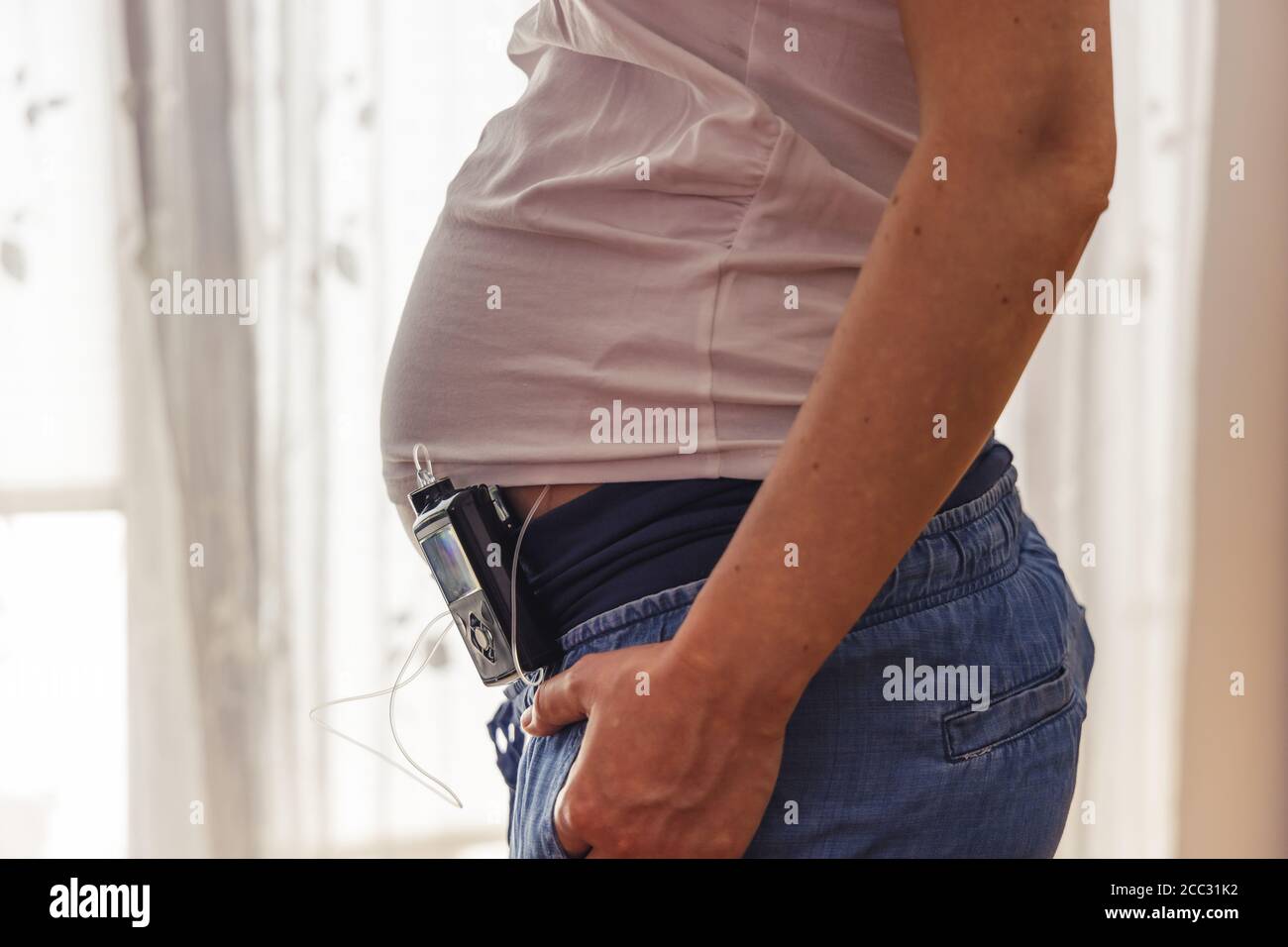 Pregnant woman with insuline pump on her pants and drainage mounted on