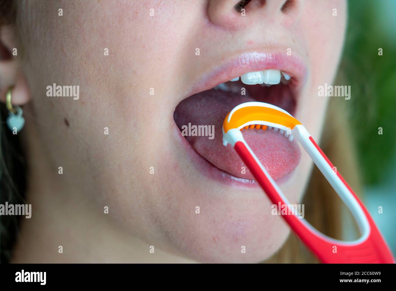 Bad breath, prevention by cleaning the tongue with a tongue brush Stock Photo