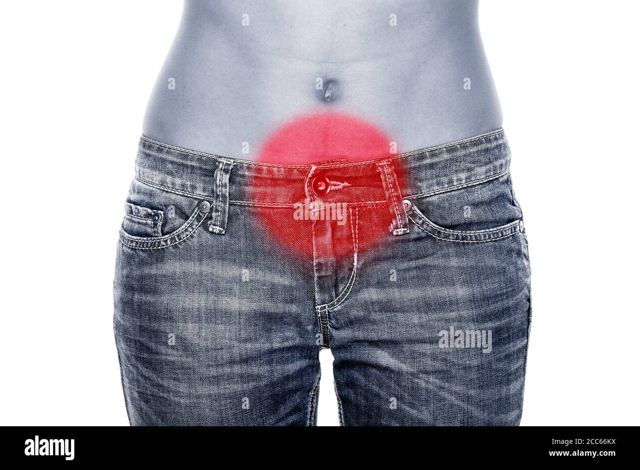 Stomach pain woman with red circle targeting painful area on lower abdomen body. Medical health care of pms menstruation cramp issue Stock Photo