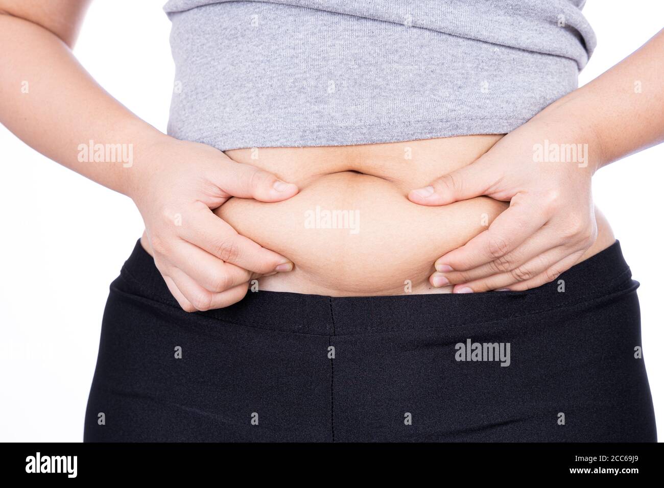 Woman grabbing skin on her flanks with black color crosses marking, Lose  weight and liposuction cellulite removal concept, Isolated on white  backgroun Stock Photo - Alamy
