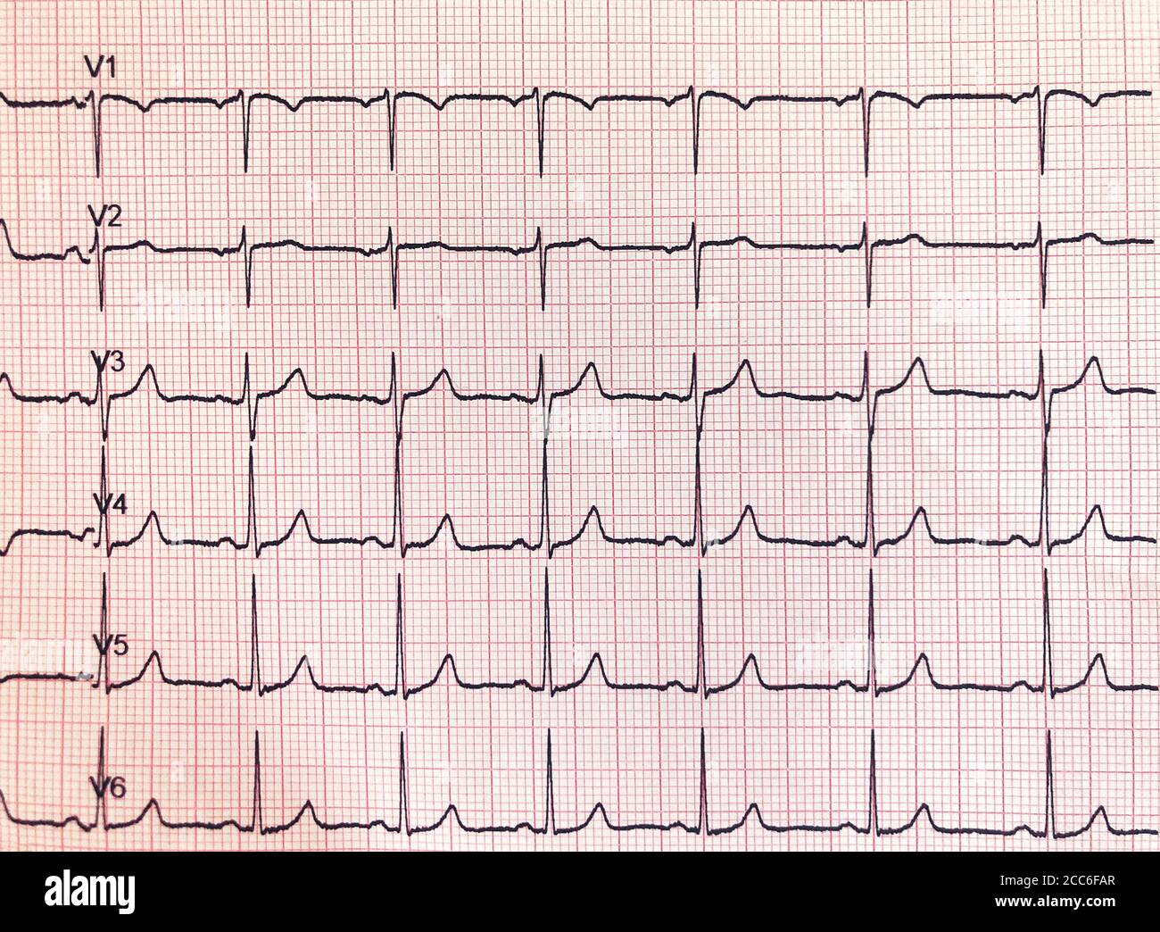 Electrocardiograma portátil fotografías e imágenes de alta resolución -  Alamy