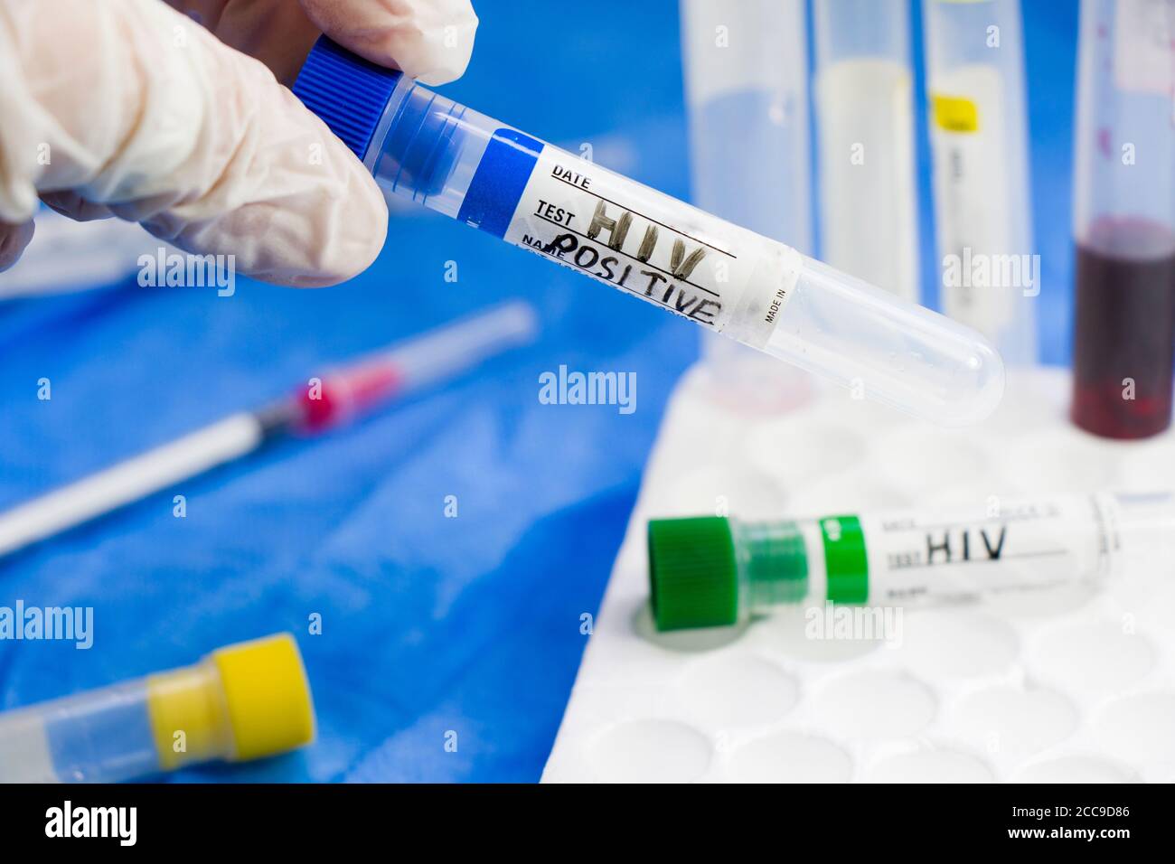 HIV and aids infection test, doctors face and hand holding tube with ...