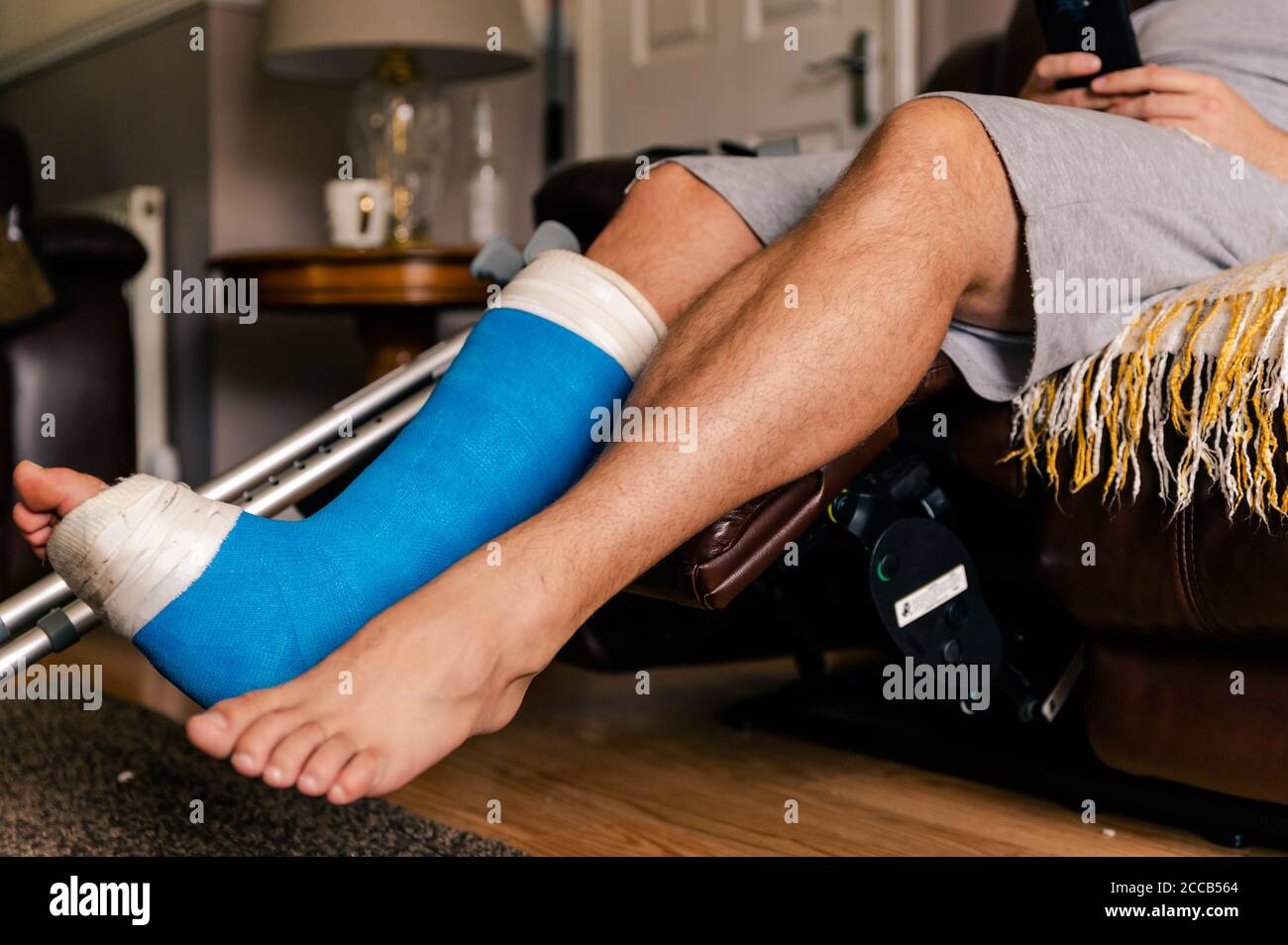 Male sat on sofa on phone with blue cast on leg.fifth metatarsal surgery. Stock Photo