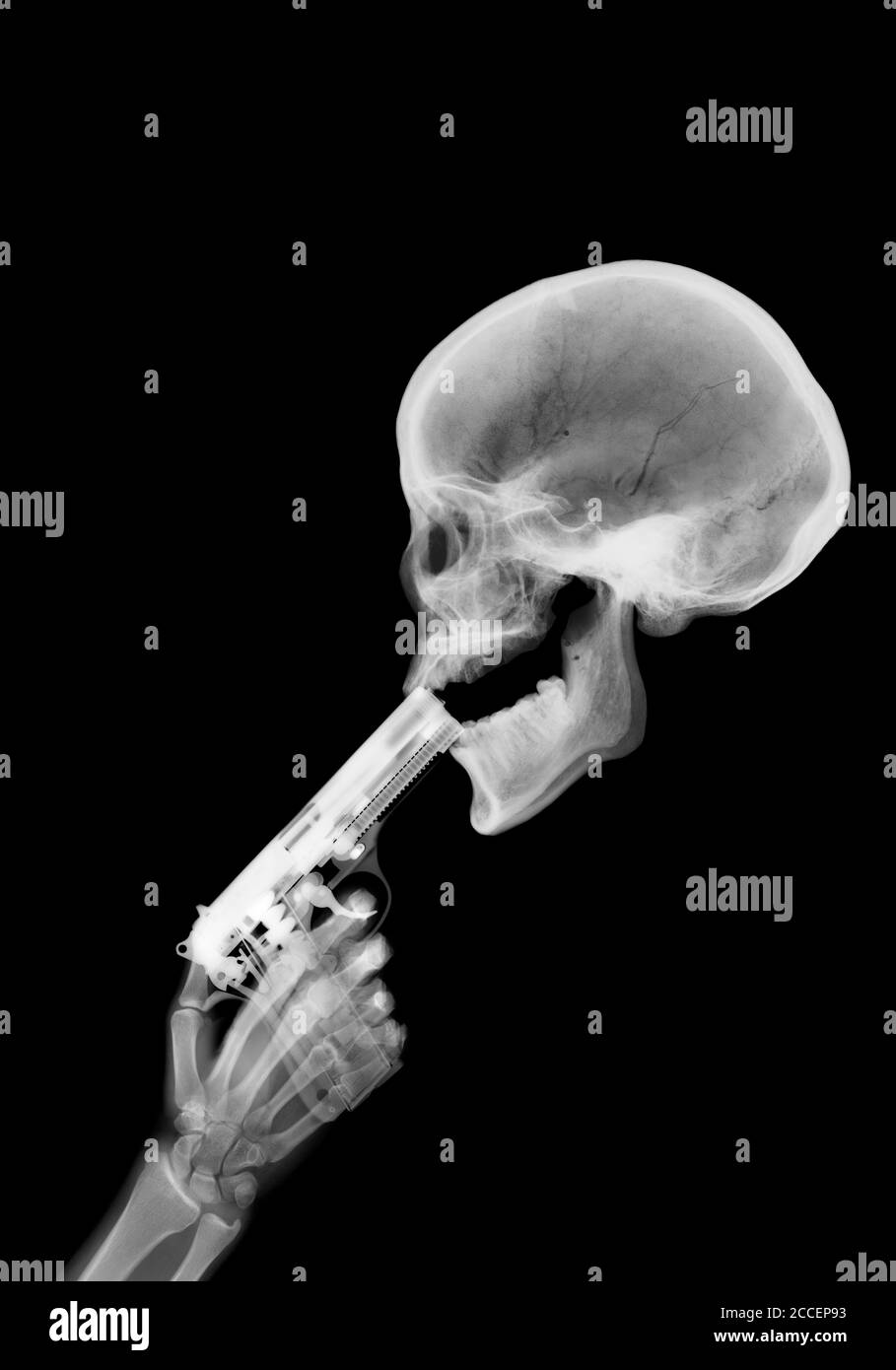 Gun and skeleton, X-ray Stock Photo