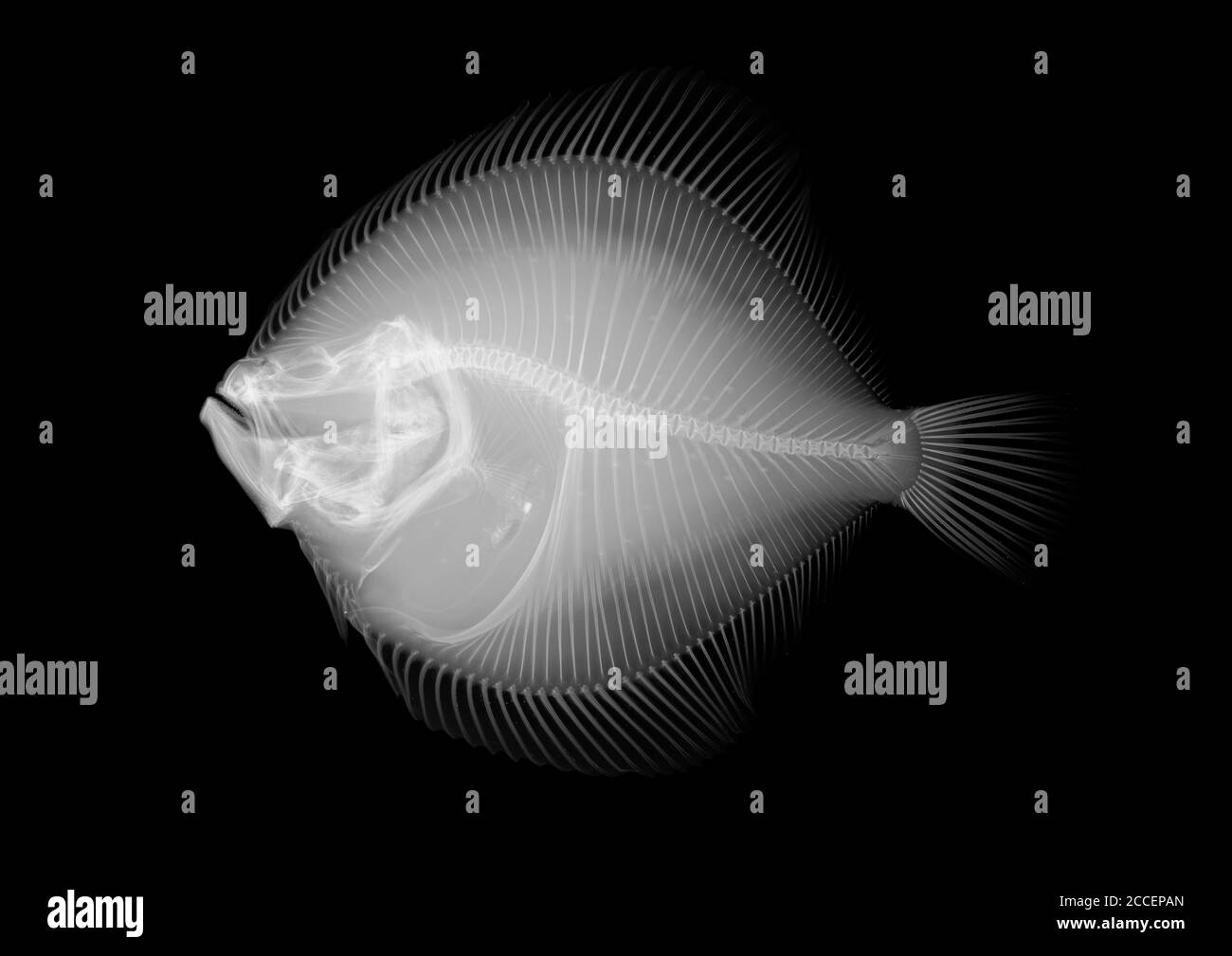 Plaice fish, X-ray Stock Photo