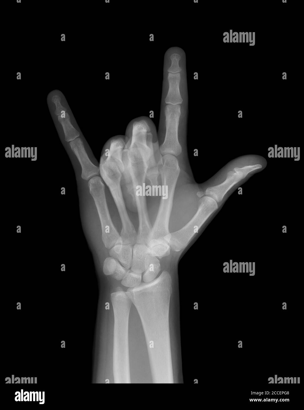 Human wrist anatomy xray view Black and White Stock Photos & Images Alamy