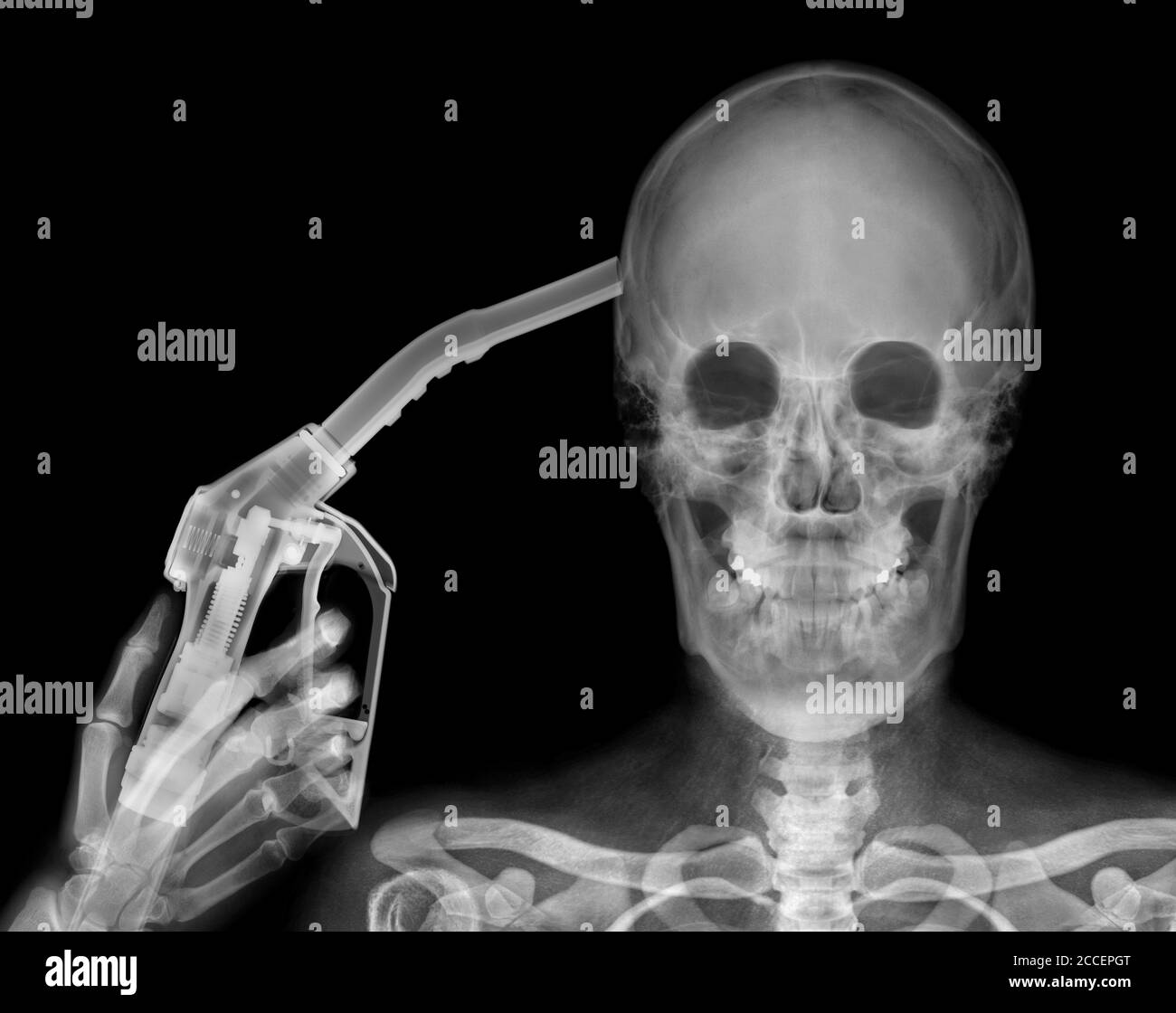 Petrol pump and skeleton, X-ray Stock Photo