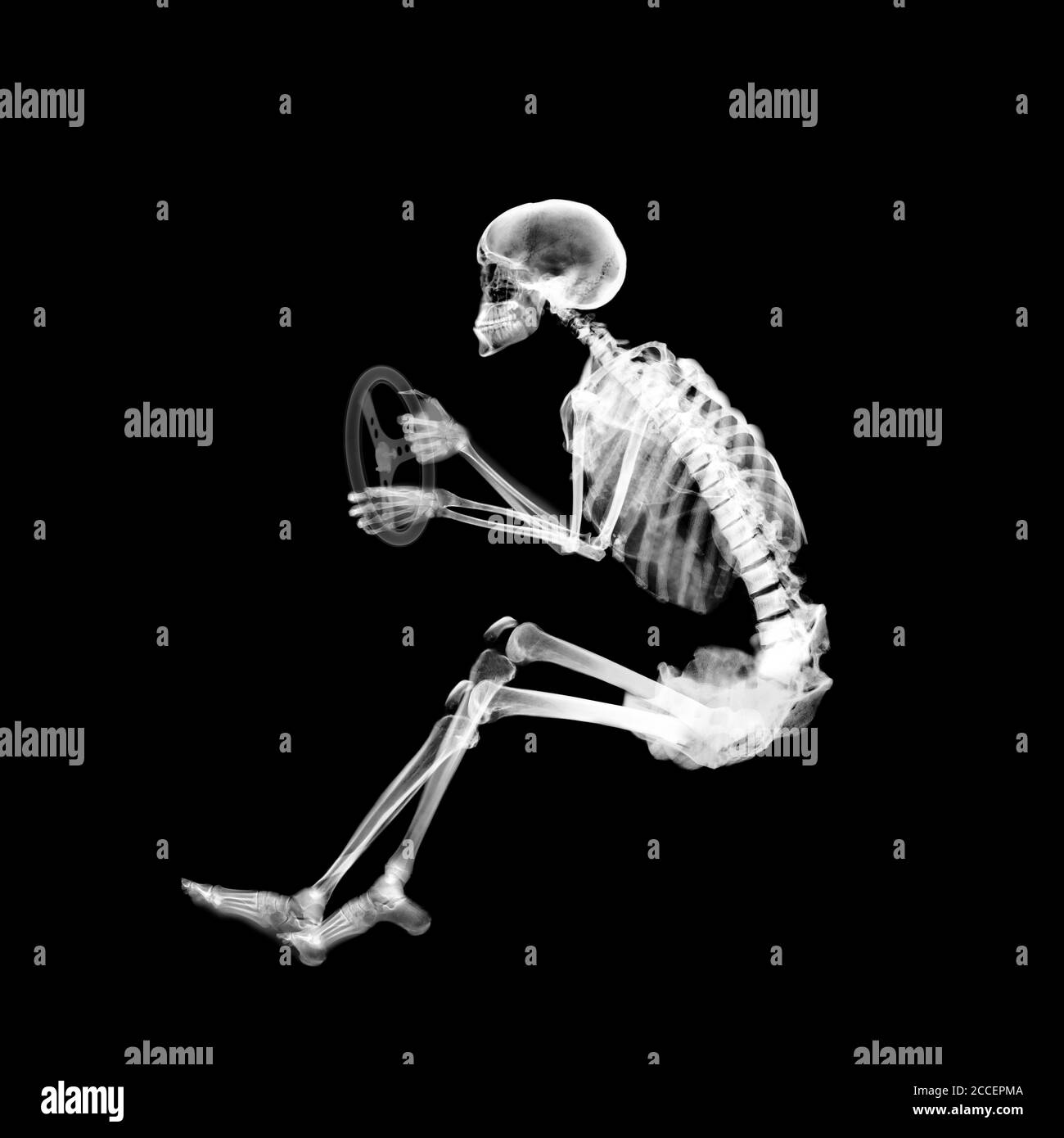 Skeleton in driving position, X-ray Stock Photo