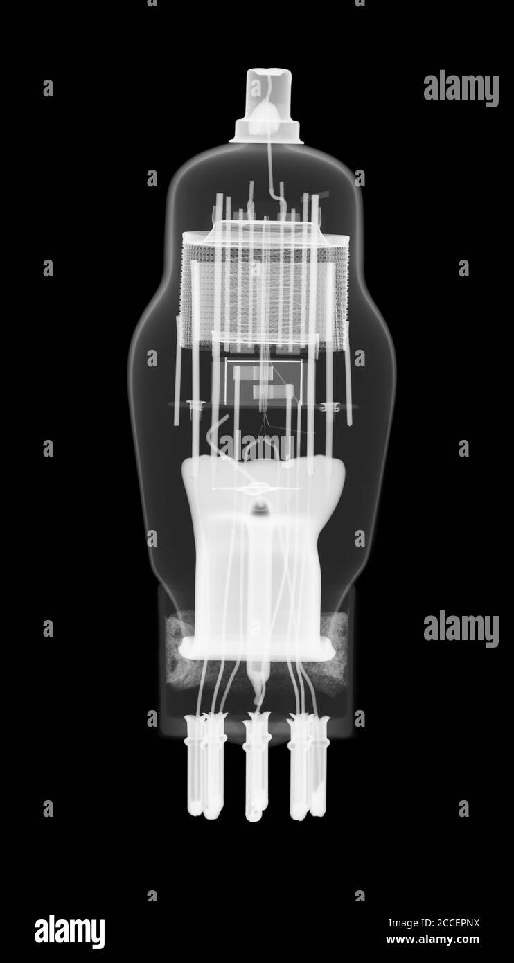 Valve bulb, X-ray Stock Photo