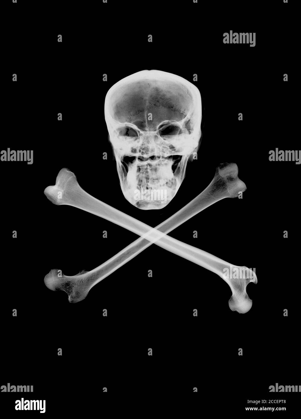 Skull and crossbones, X-ray Stock Photo