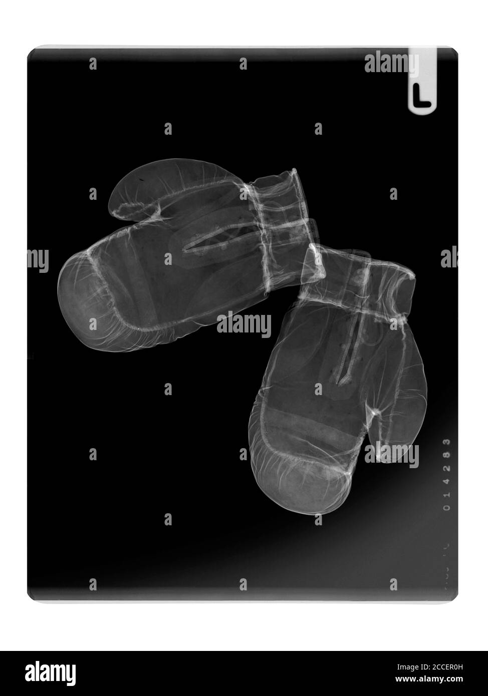 Boxing gloves, X-ray Stock Photo