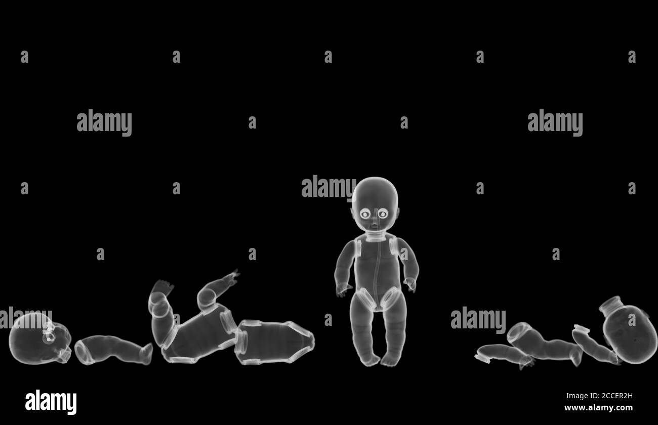 Plastic baby doll toys, Xray Stock Photo Alamy