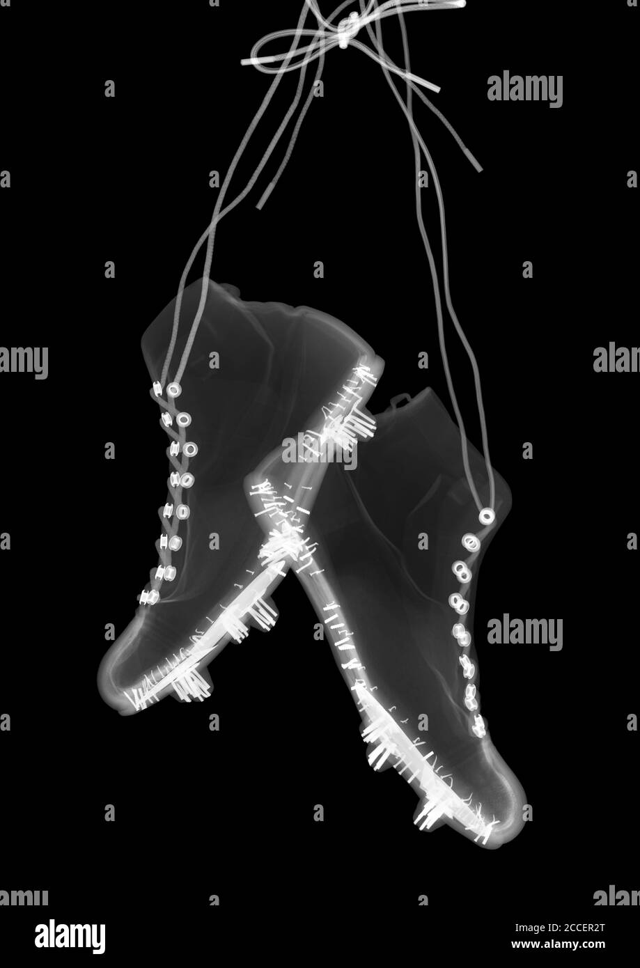 Football boots, X-ray Stock Photo