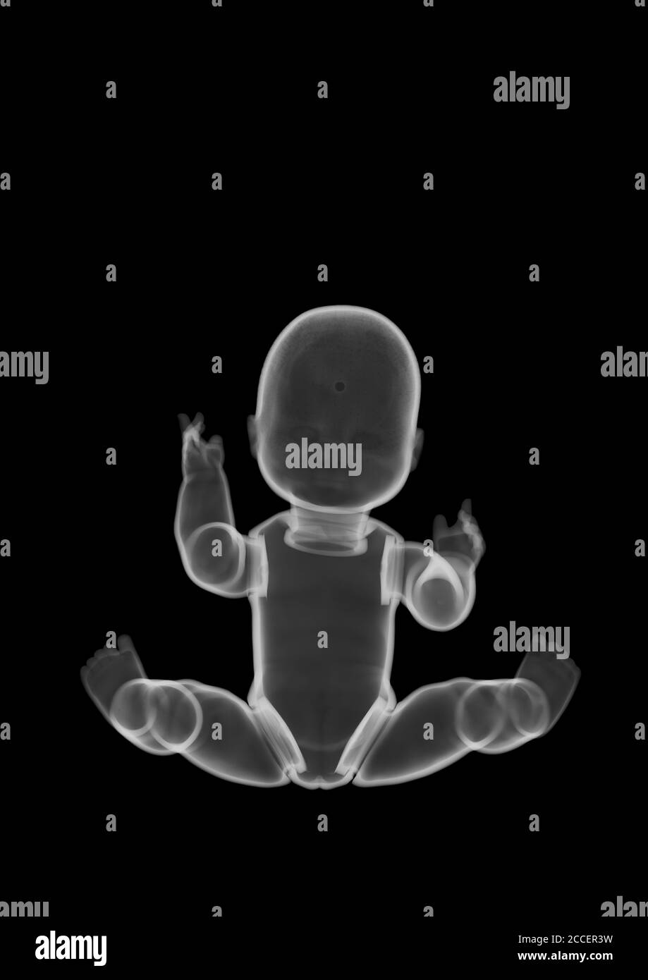 Plastic baby doll toy, X-ray Stock Photo