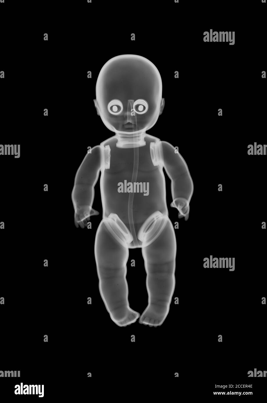 Plastic baby doll toy, X-ray Stock Photo