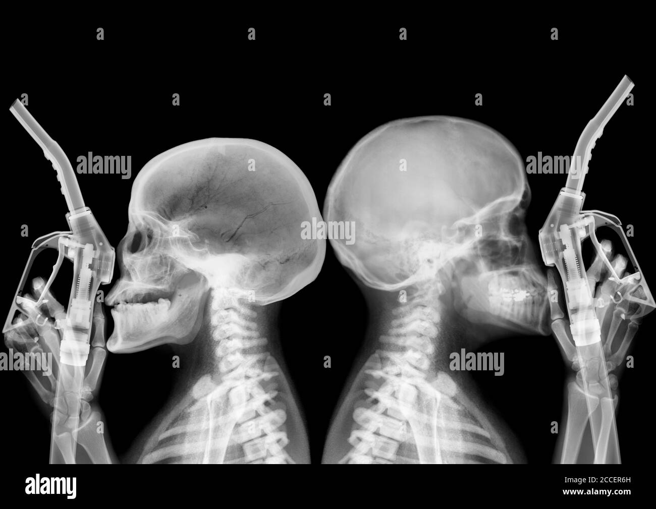 Petrol gasoline pumps and skeletons, X-ray Stock Photo