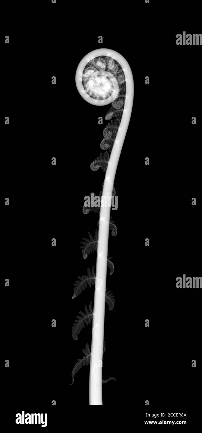 Tree fern (Dicksonia sp.), X-ray Stock Photo