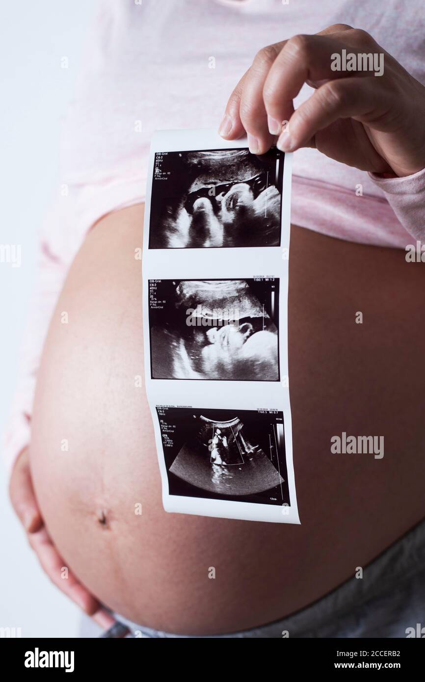 Pregnant woman holding baby scans Stock Photo