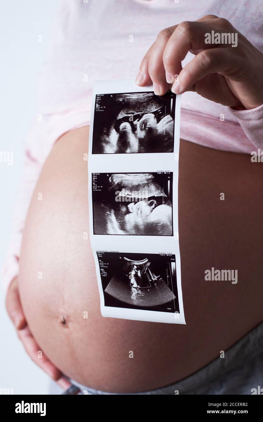 Three month ultrasound hi-res stock photography and images - Alamy