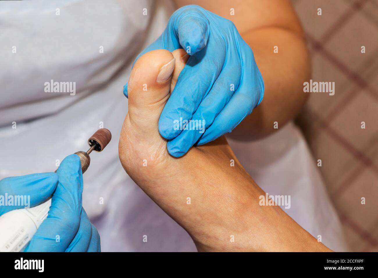 Professional pedicure using dieffenbach scalpel.Patient visiting