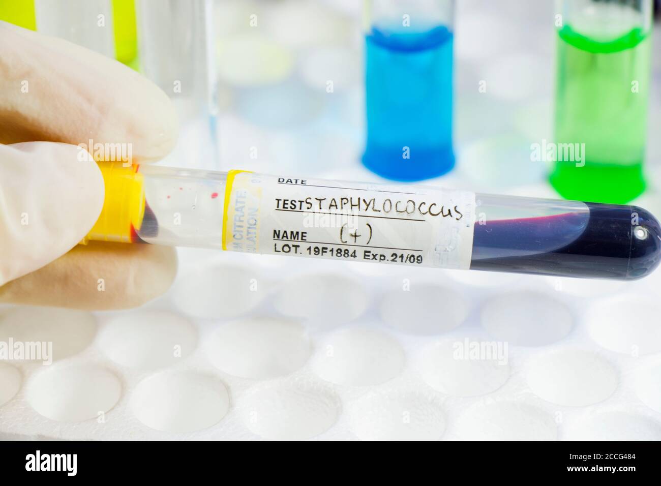 Staphylococci bacteria, blood test tube samples Stock Photo Alamy