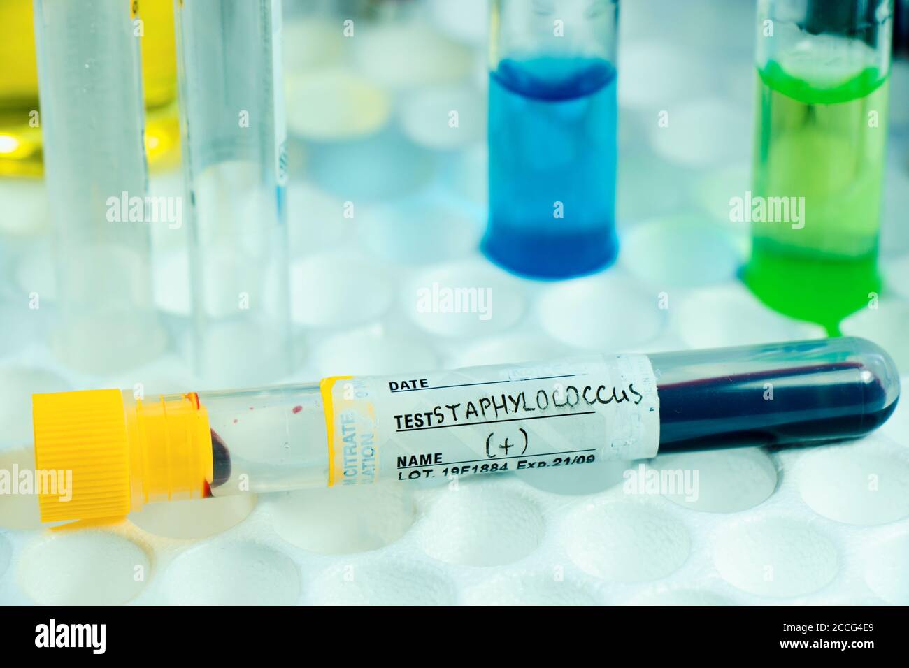 Staphylococci bacteria, blood test tube samples Stock Photo Alamy