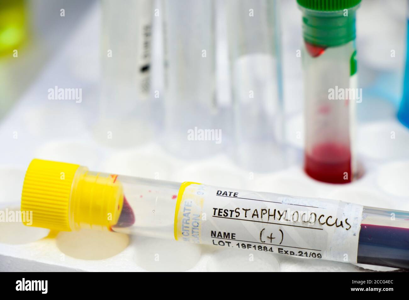 Staphylococci Bacteria High Resolution Stock Photography and Images Alamy