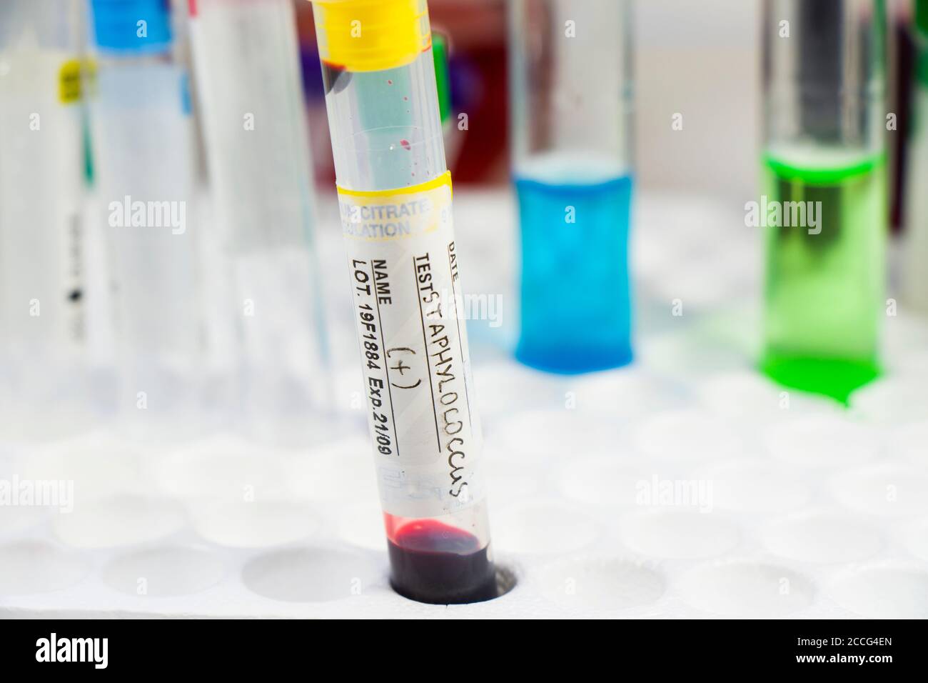 Staphylococci bacteria hires stock photography and images Alamy