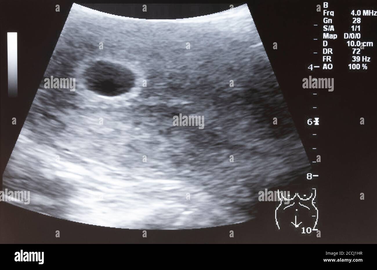 Baby ultrasound hi-res stock photography and images - Alamy