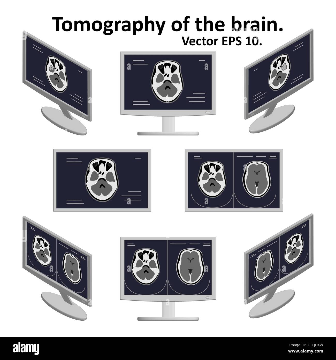 Set of cross section of the brain during magnetic resonance imaging on a computer screen in isometric view. A few pictures of the image of the brain. Stock Vector