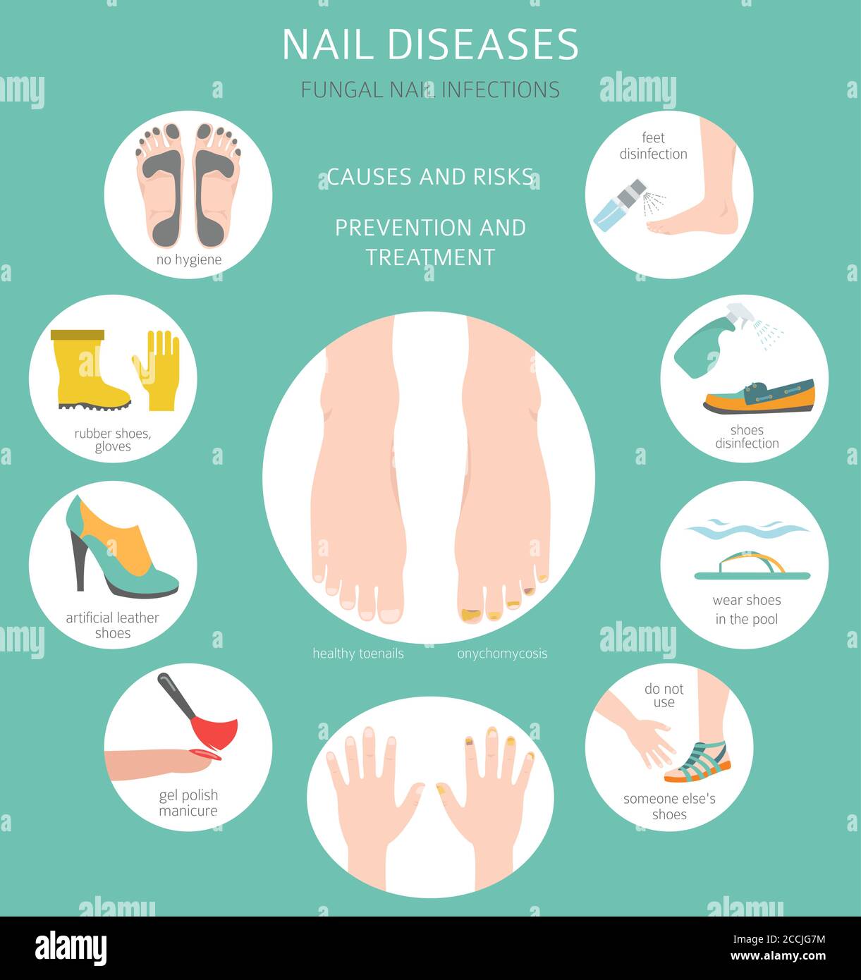 Causes Of Nail Infection Tinea Unguium Symptoms Causes Diagnosis 