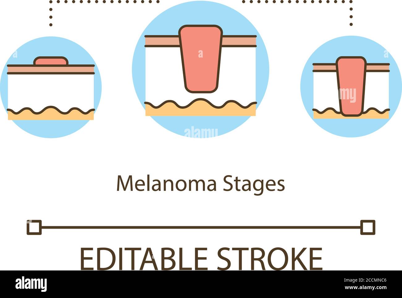 Melanoma stages concept icon Stock Vector Image & Art Alamy