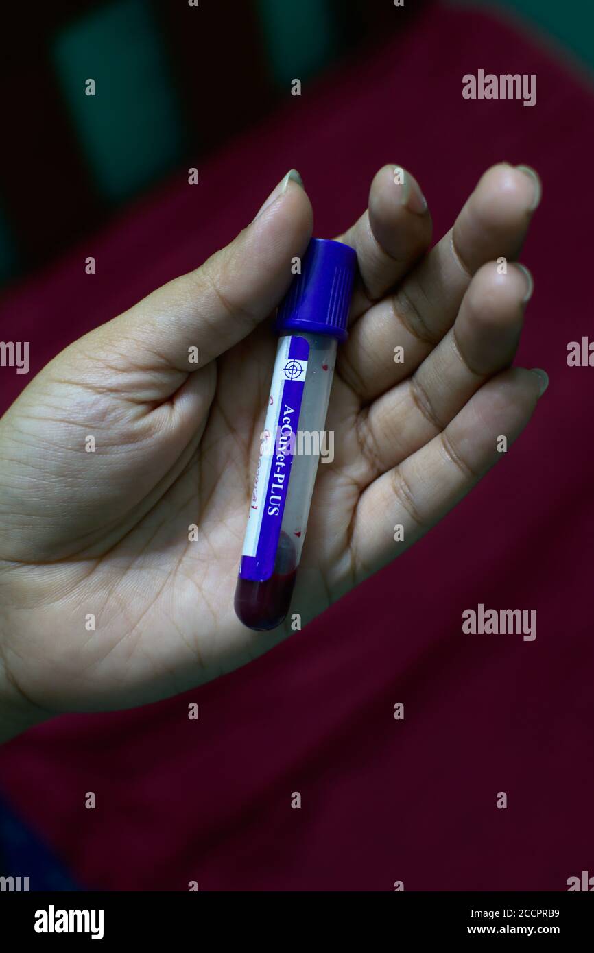 Female lab technician holding vial or anticoagulant container with