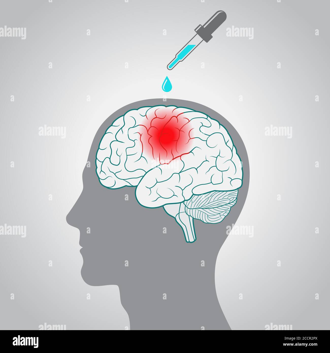 The concept of treating diseases of the brain stock vector image art