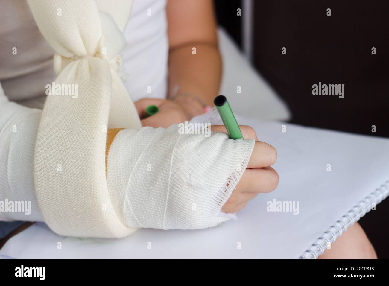 Little girl with hand in cast, trying to draw, recovery Stock Photo