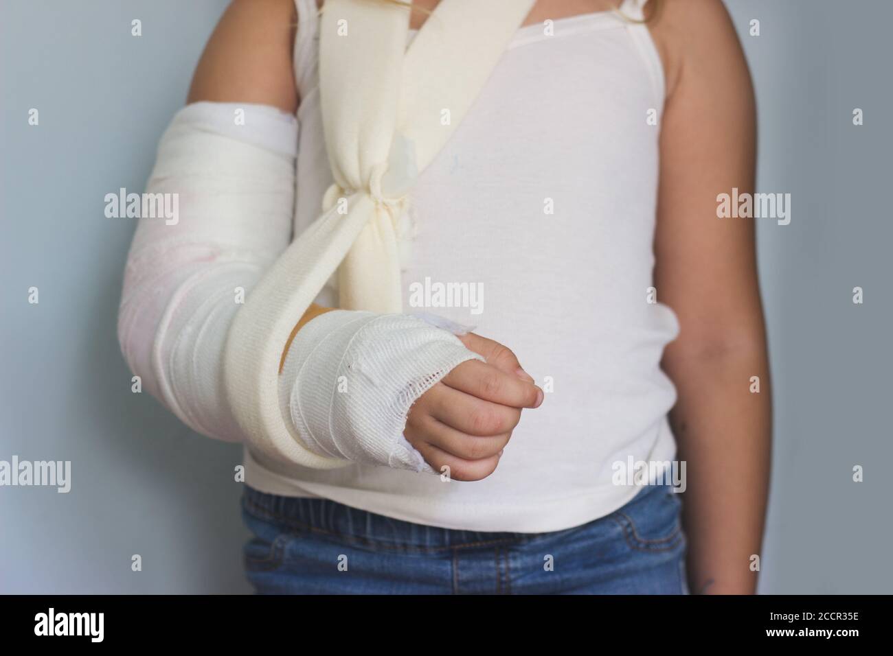 Hand In Plaster Little girl with broken hand, in plaster, against blue wall Stock Photo ...