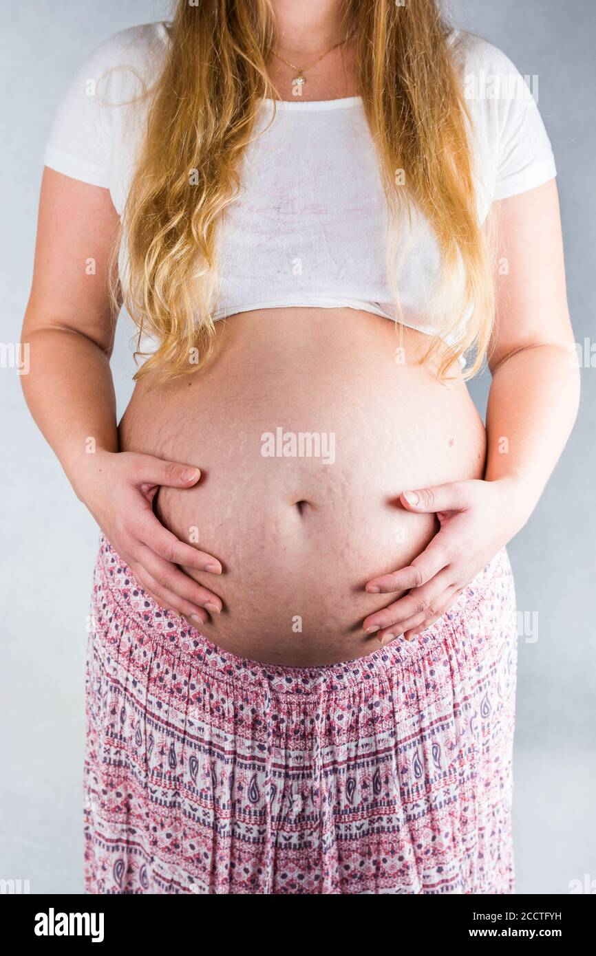 Front view on belly with stretchmarks of pregnant woman on light background Stock Photo