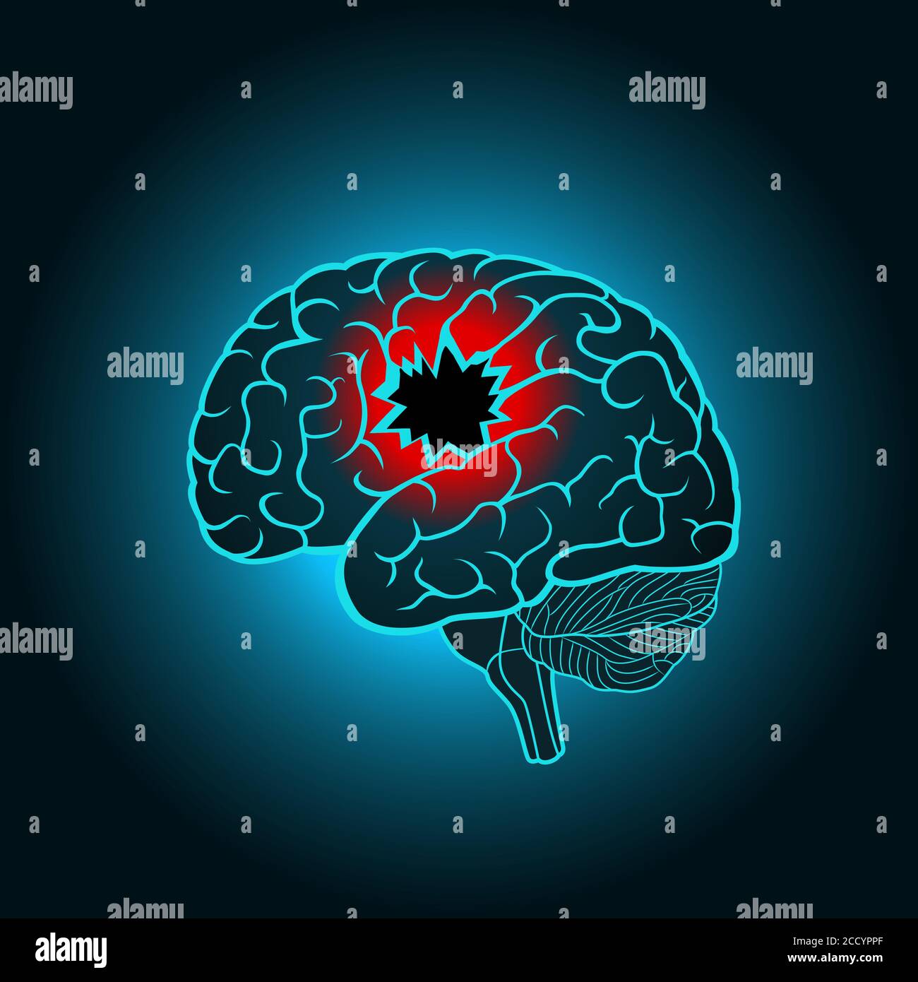 A brain with a hole, the concept of destruction of the brain, memory