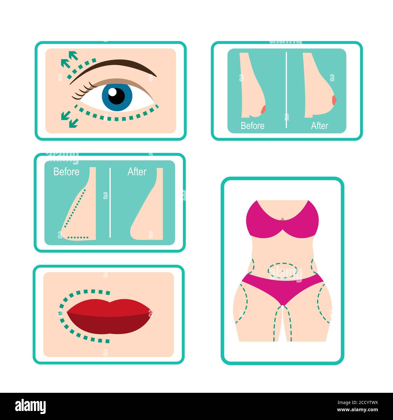Plastic surgery icon set in flat style Stock Vector